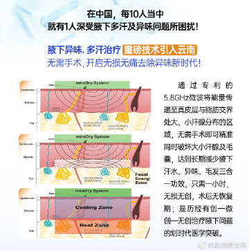 最新腋嗅疗法，突破传统，走向高效治疗的新时代